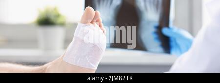 Un medico guarda una radiografia della gamba ferita di un uomo, sfocata Foto Stock