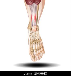 Osso umano della gamba anteriore e muscoli su sfondo bianco Foto Stock