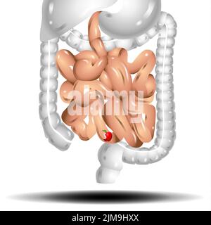 Intestini. Rappresentazione realistica del vettore piatto dell'intestino tenue e grande. Organo interno umano, tratto digestivo su sfondo bianco Foto Stock