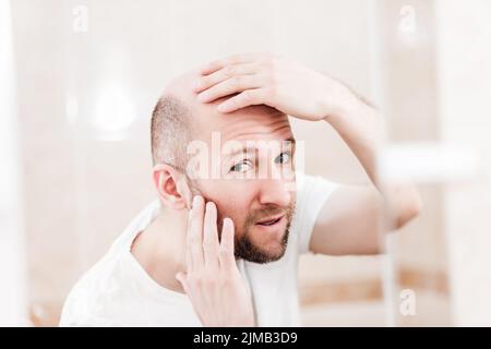Calvo uomo guardando specchio di calvizie e perdita di capelli Foto Stock