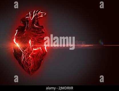 Attacco di cuore, illustrazione concettuale Foto Stock