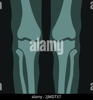 Raggi X del corpo umano, ossa delle ginocchia e vettore delle articolazioni Illustrazione Vettoriale