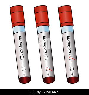 Diagnosi di campioni di sangue per il virus della scimmietta. Provette con test paziente. Set vettoriale colorato. Tre risultati: Positivo, negativo, incompiuto. Illustrazione Vettoriale