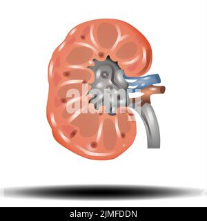 Rene - organo interno, calcoli renali. Calcoli renali, nefrolitiasi o urolitiasi. Concetto di assistenza sanitaria, illustrazione vettoriale su sfondo bianco Foto Stock