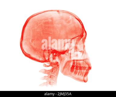 Cranio umano. Immagine radiografica rossa su sfondo bianco Foto Stock