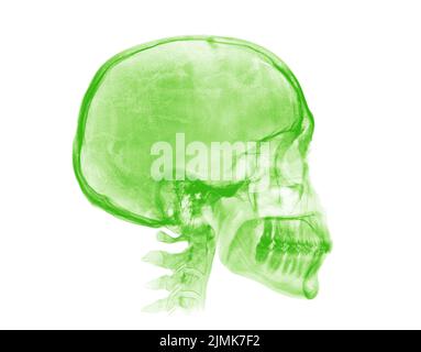 Cranio umano. Immagine radiografica verde su sfondo bianco Foto Stock