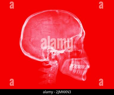 Cranio umano. Immagine radiografica su sfondo rosso Foto Stock