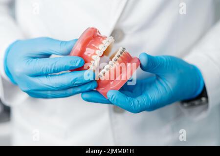 Primo piano delle mani maschili del medico in guanti che tengono le ganasce umane protesiche con le bretelle metalliche. Visita al dentista, concetto ortodontista. Foto Stock
