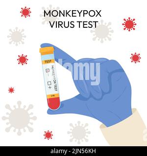 La mano di un medico in un guanto protettivo contiene una provetta. Test del virus Monkeypox. Test positivo o negativo. Sistemi di test. Illustrazione Vettoriale