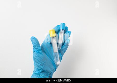 provetta sottovuoto per il prelievo e campioni di sangue in guanti blu per laboratorio. Su sfondo bianco Foto Stock