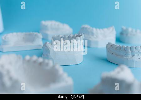 Molti modelli di denti in gesso su sfondo blu Foto Stock