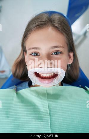 Paziente giovane con apribocca dentale prima di un esame medico Foto stock  - Alamy