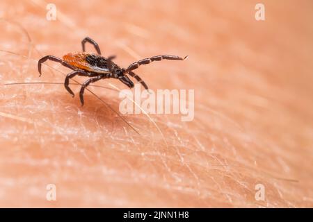 Primo piano di corsa parassita cervi zecca sulla pelle umana testurizzata. Ixodes ricinus. Parassita di insetto pericoloso in movimento dinamico. Encefalite, malattia di Lyme. Foto Stock