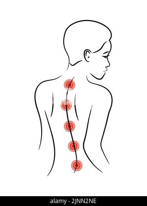 Illustrazione del vettore dolore alla schiena. Design del logo della diagnostica della colonna vertebrale. Illustrazione Vettoriale