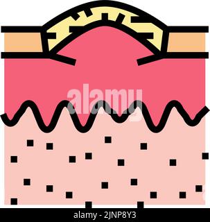 boxcar acne cicatrice colore icona vettore illustrazione Illustrazione Vettoriale