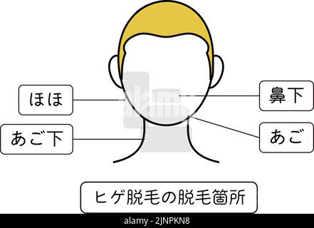 Illustrazione delle aree di epilazione per la rimozione dei peli della barba - traduzione: Guance, sotto il mento, il naso, il mento, le aree di epilazione della barba Illustrazione Vettoriale