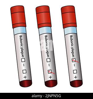 Provette con analisi del paziente. Set di vettori colorati. Diagnosi di campioni di sangue per peste bubbonica. Tre risultati: Positivo, negativo, non preparato. Illustrazione Vettoriale