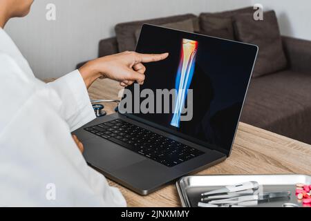 Primo piano del medico che mostra una radiografia di dolore al ginocchio Foto Stock