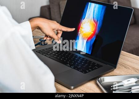 Primo piano del medico che mostra una radiografia di dolore al ginocchio Foto Stock