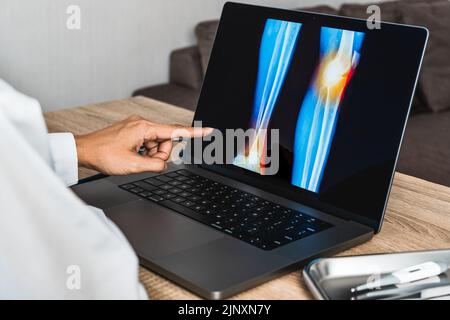 Primo piano del medico che mostra una radiografia di dolore al ginocchio Foto Stock