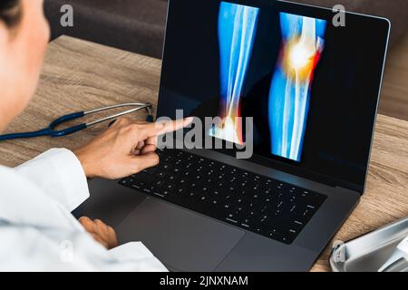 Primo piano del medico che mostra una radiografia di dolore al ginocchio Foto Stock