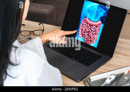 Medico che mostra una radiografia dello stomaco e dell'intestino Foto Stock