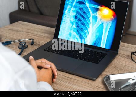 Medico che cerca una radiografia di dolore alle spalle di un notebook. Foto Stock