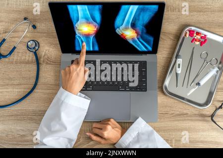 Vista dall'alto del medico che mostra una radiografia del dolore al ginocchio Foto Stock