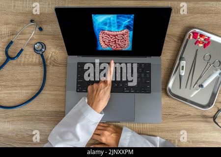 Vista dall'alto del medico che mostra una radiografia dello stomaco e dell'intestino Foto Stock