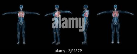 3d set di rappresentazione di radiografie polmonari del corpo umano femminile isolate su sfondo nero. Foto Stock