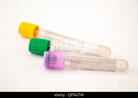 Provette per analisi del sangue di colore giallo, verde e viola su sfondo bianco isolato Foto Stock