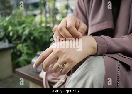 giovani donne che soffrono di prurito della pelle seduta su panca in un parco Foto Stock