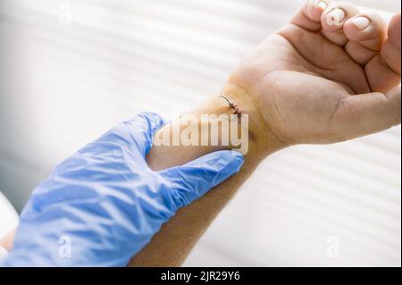 Il medico di raccolto esamina i punti sulla ferita Foto Stock