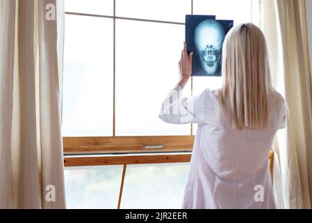 Il medico di sesso femminile esamina i raggi X dei pazienti cranio Foto Stock