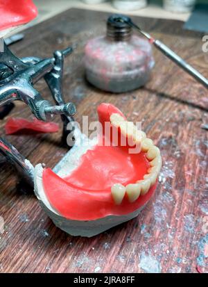 Protesi artificiali nelle fasi di produzione del laboratorio odontoiatrico. Stampo ortodontico dentale con utensili. Protesi naturale completa di qualità Foto Stock