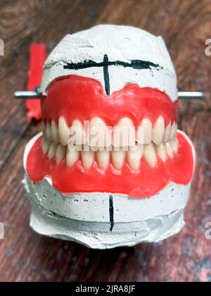Protesi dentarie rimovibili complete su modelli in gesso. Protesi integrale naturale realizzata con materiali di qualità in gesso modello. Messa a fuoco selettiva, primo piano Foto Stock