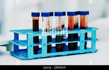 Sangue da closeup, provetta o ricerca medica in laboratorio scientifico per l'analisi, il controllo o l'esame del campione di DNA. Alla ricerca di una cura rivoluzionaria per Foto Stock