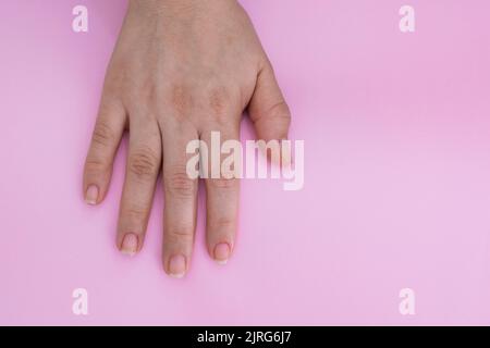 dettaglio in primo piano della mano di una ragazza, posta su uno sfondo rosa, mano destra della donna con unghie disordinate pronto per iniziare a pulire e dipingere nella b Foto Stock