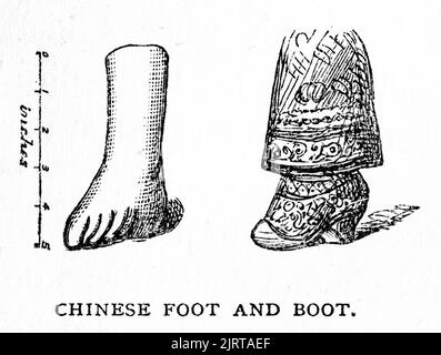 Incisione dei piedi legati delle donne cinesi, da A Voyage in the Sunbeam della baronessa Anna 'Annie' Brassey (1839 – 1887), pubblicata nel 1878 Foto Stock