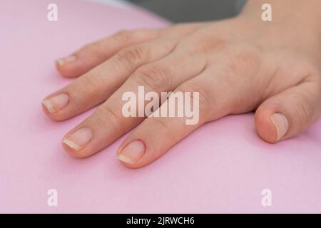 dettaglio primo piano della mano di una ragazza, posta su uno sfondo rosa, mano destra della donna con unghie disordinate pronto per iniziare a pulire e dipingere nella bellezza Foto Stock