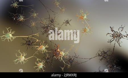 Lieve traumatica lesione cerebrale, neuroni danneggiati, malattia di alzheimers, diffusa lesione assonale, interruzione nella comunicazione nervosa, 3D rendere Foto Stock