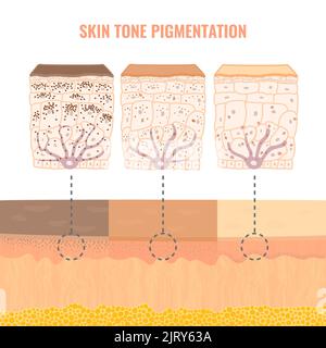 Pigmentazione cutanea, illustrazione Foto Stock