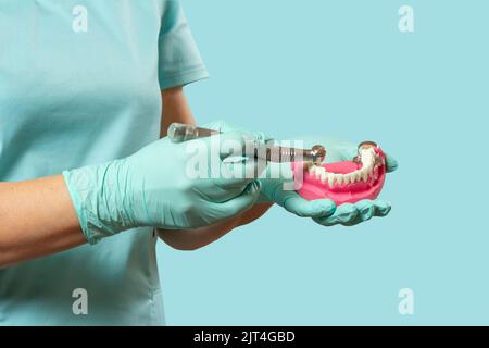 Testa del manipolo dentale ad alta velocità con il bur e la disposizione di una mandibola umana nelle mani del dentista. Strumenti dentali per trattamento dentale. Foto Stock