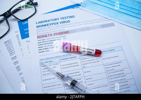 Provette per il prelievo ematico e scheda tecnica sui risultati positivi del test sul monkeypox nei laboratori Foto Stock