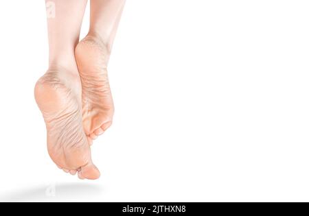 belle ed eleganti gambe femminili con pelle secca e ruvida su suole e tacchi. Suole secche e spaccate di piedi. Gambe femminili in una posizione elegante isolato o Foto Stock
