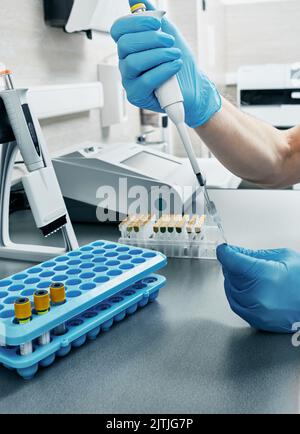 Tecnico di laboratorio con micropipetta per analisi di analisi determina il tipo di sangue della persona utilizzando la tecnologia gel, primo piano Foto Stock