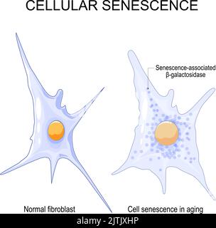 Senescenza cellulare. Cambia le cellule senescenti durante l'invecchiamento. Confronto e differenza tra fibroblasto normale e senescenza cellulare nell'invecchiamento. Vettore Illustrazione Vettoriale