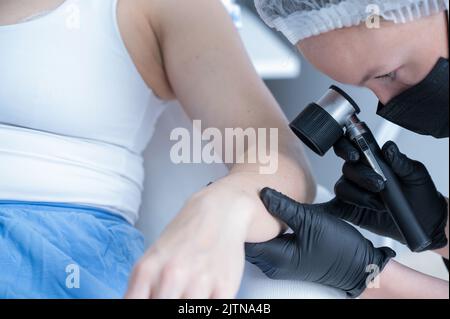 Un dermatologo esamina la talpa di un paziente attraverso un dermatoscopio. Foto Stock