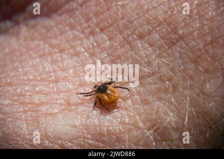 Fagiolo di ricino femmina lungo circa 3 millimetri, sulla pelle umana * weibliche Zecke auf menschlicher Haut Foto Stock