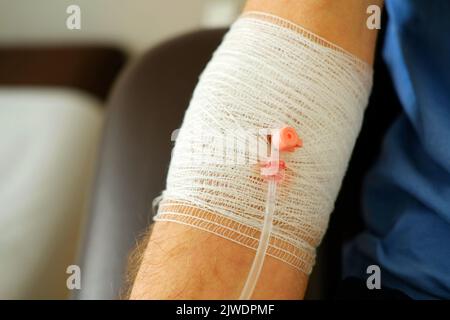 catetere venoso periferico con dr Foto Stock